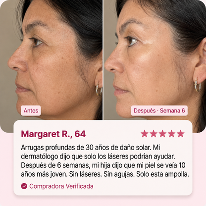 Ampolla Lifting de Colageno con Peptidos de Seda ValoraBeauty™