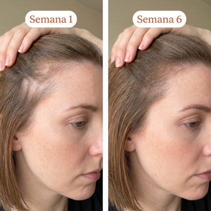 Sérum Capilar de Crecimiento Coreano · Valora Beauty